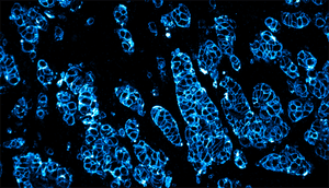 Företrädesemission 2025