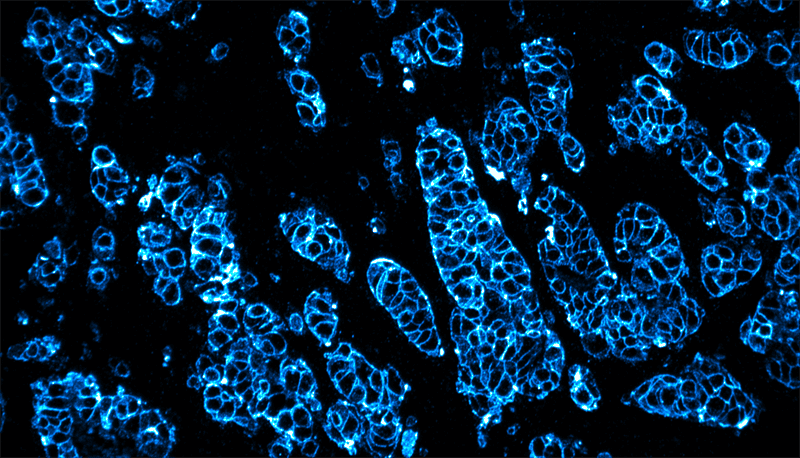 Sista dag för handel med uniträtter i Lumitos företrädesemission