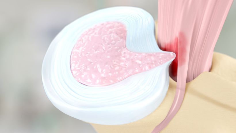 Stayble Therapeutics STA363